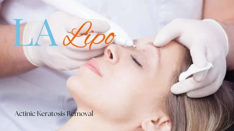 Woman receiving Actinic Keratosis Removal Treatment Birmingham