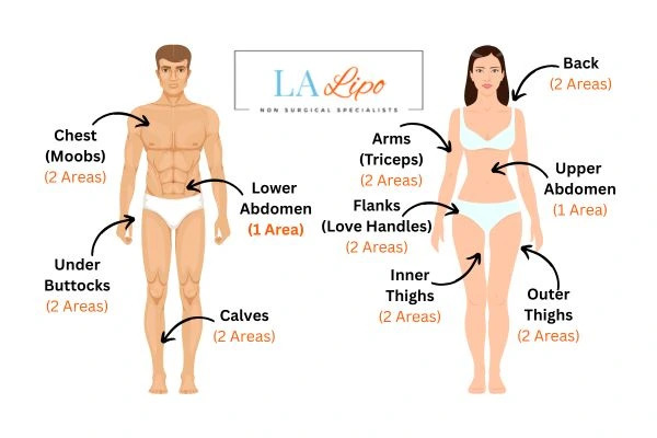 LA LIPO Cryolipolysis Areas Birmingham