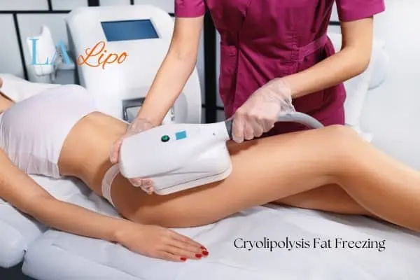 Woman receiving coolsculpting Birmingham treatment on her thighs
