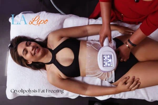 woman getting cryolipolysis Birmingham