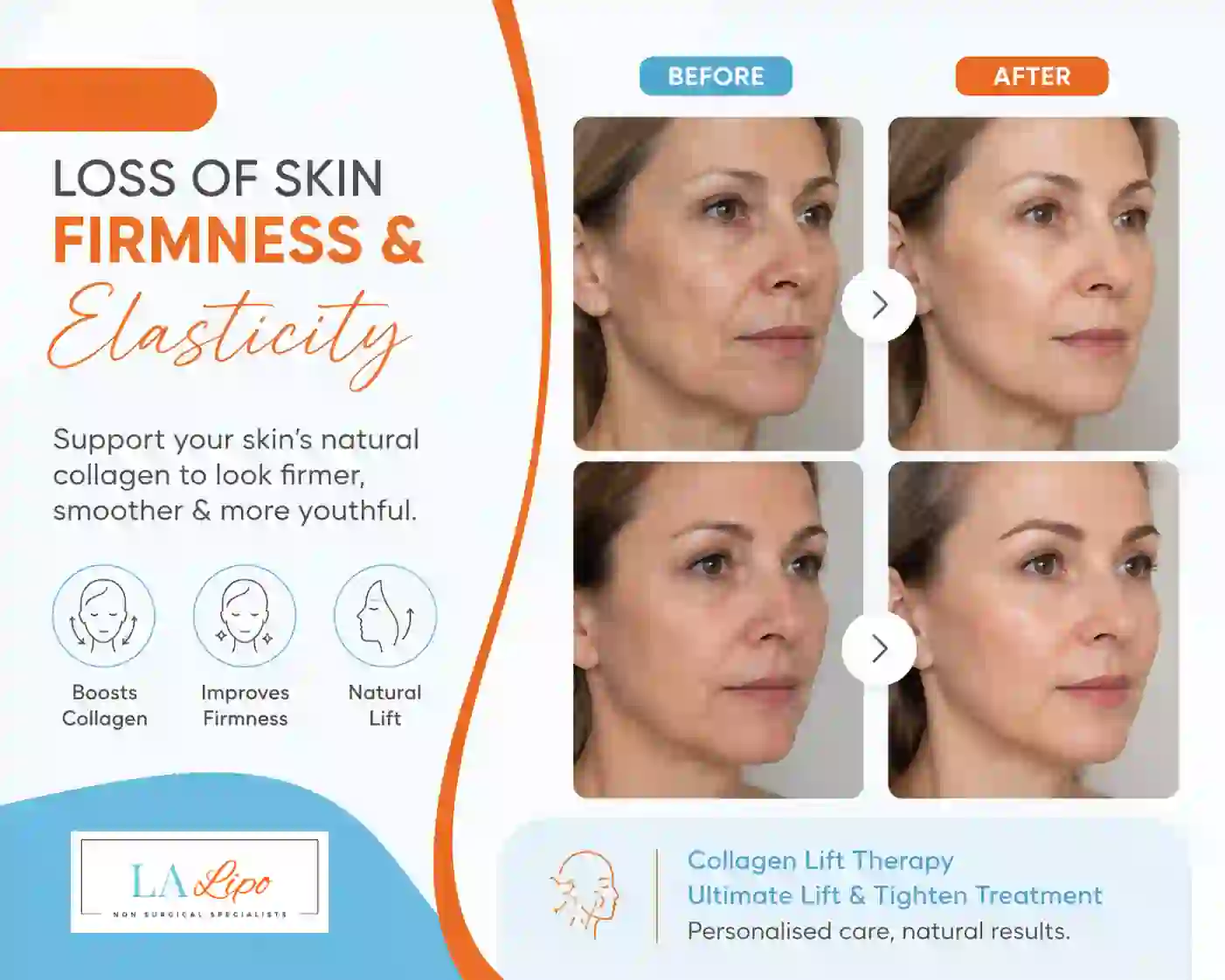 Sign #7: Loss of Skin Firmness and Elasticity Birmingham